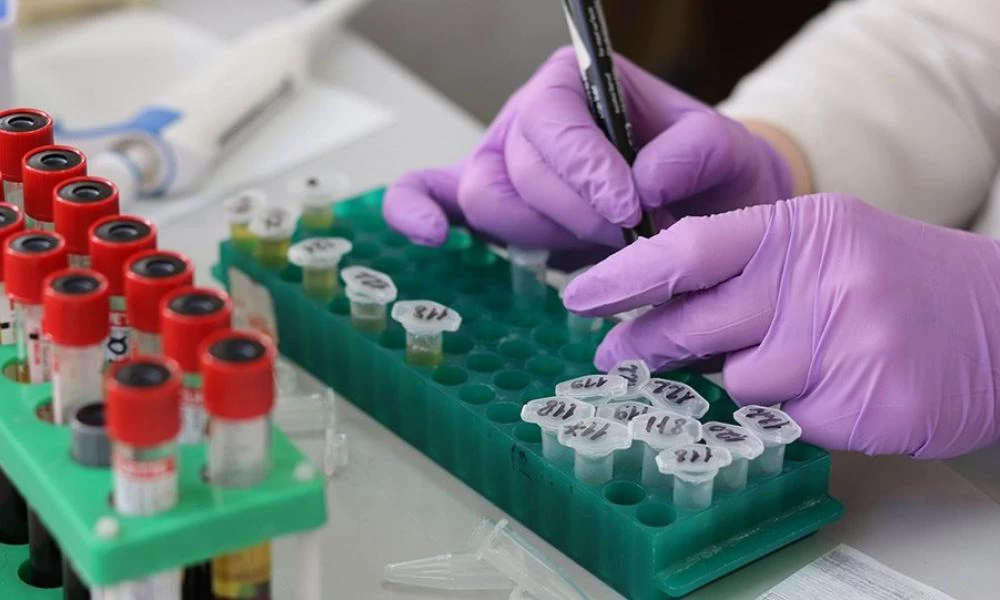 Κορονοϊός: Σταματά στις ΗΠΑ η δοκιμής της θεραπείας με πλάσμα αίματος ασθενών που ανάρρωσαν